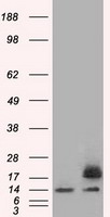 PFN1 / Profilin 1 Antibody - HEK293T cells were transfected with the pCMV6-ENTRY control (Left lane) or pCMV6-ENTRY PFN1 (Right lane) cDNA for 48 hrs and lysed. Equivalent amounts of cell lysates (5 ug per lane) were separated by SDS-PAGE and immunoblotted with anti-PFN1.