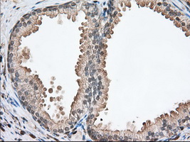PFN1 / Profilin 1 Antibody - Immunohistochemical staining of paraffin-embedded Human prostate tissue using anti-PFN1 mouse monoclonal antibody. (Dilution 1:50).