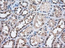 PFN1 / Profilin 1 Antibody - Immunohistochemical staining of paraffin-embedded Human Kidney tissue using anti-PFN1 mouse monoclonal antibody. (Dilution 1:50).