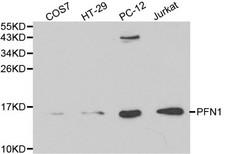 PFN1 / Profilin 1 Antibody - Western blot of PFN1 pAb in extracts from COS7, HT29, PC12 and Jurkat cells.