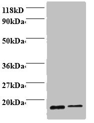 PFN1 / Profilin 1 Antibody - Western blot All lanes: Profilin-1 antibody at 2µg/ml Lane 1: EC109 whole cell lysate Lane 2: 293T whole cell lysate Secondary Goat polyclonal to rabbit IgG at 1/15000 dilution Predicted band size: 16 kDa Observed band size: 16 kDa