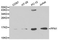 PFN1 / Profilin 1 Antibody - Western blot analysis of extracts of various cell lines, using PFN1 antibody at 1:1000 dilution. The secondary antibody used was an HRP Goat Anti-Rabbit IgG (H+L) at 1:10000 dilution. Lysates were loaded 25ug per lane and 3% nonfat dry milk in TBST was used for blocking.