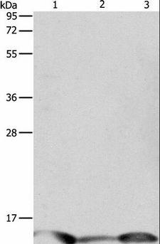 PFN1 / Profilin 1 Antibody - Western blot analysis of Human seminoma tissue, HeLa and A549 cell, using PFN1 Polyclonal Antibody at dilution of 1:1000.
