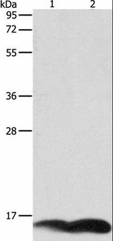 PFN1 / Profilin 1 Antibody - Western blot analysis of A549 and Jurkat cell, using PFN1 Polyclonal Antibody at dilution of 1:1000.