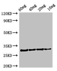 PFN1 / Profilin 1 Antibody - Western Blot Positive WB detected in Recombinant protein All lanes: Profilin antibody at 2.7µg/ml Secondary Goat polyclonal to rabbit IgG at 1/50000 dilution Predicted band size: 31 kDa Observed band size: 31 kDa