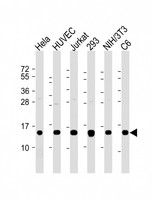 PFN1 / Profilin 1 Antibody - All lanes: Anti-Profilin-1 Antibody at 1:2000 dilution Lane 1: Hela whole cell lysate Lane 2: HUVEC whole cell lysate Lane 3: Jurkat whole cell lysate Lane 4: 293 whole cell lysate Lane 5: NIH/3T3 whole cell lysate Lane 6: C6 whole cell lysate Lysates/proteins at 20 µg per lane. Secondary Goat Anti-Rabbit IgG, (H+L), Peroxidase conjugated at 1/10000 dilution. Predicted band size: 15 kDa Blocking/Dilution buffer: 5% NFDM/TBST.