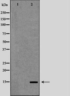 PFN1 / Profilin 1 Antibody - Western blot analysis of HeLa whole cells lysates using PFN1 antibody. The lane on the left is treated with the antigen-specific peptide.