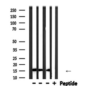 PFN1 / Profilin 1 Antibody - Western blot analysis of PFN1 expression in various lysates