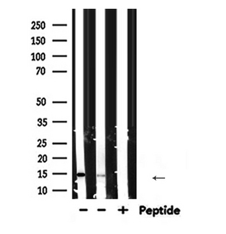 PFN1 / Profilin 1 Antibody - Western blot analysis of PFN1 expression in various lysates