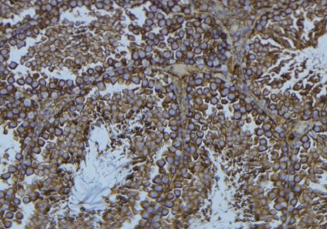 PFN1 / Profilin 1 Antibody - 1:100 staining mouse testis tissue by IHC-P. The sample was formaldehyde fixed and a heat mediated antigen retrieval step in citrate buffer was performed. The sample was then blocked and incubated with the antibody for 1.5 hours at 22°C. An HRP conjugated goat anti-rabbit antibody was used as the secondary.