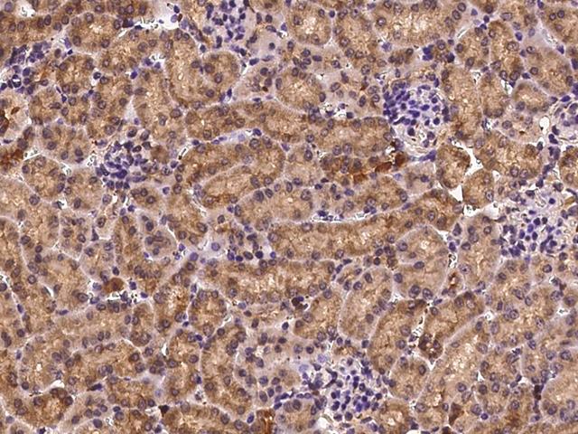 PFN1 / Profilin 1 Antibody - Immunochemical staining PFN1 in mouse kidney with rabbit polyclonal antibody at 1:500 dilution, formalin-fixed paraffin embedded sections.