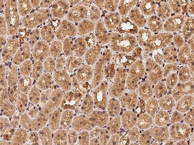 PFN1 / Profilin 1 Antibody - Immunochemical staining PFN1 in rat kidney with rabbit polyclonal antibody at 1:500 dilution, formalin-fixed paraffin embedded sections.