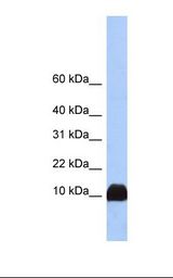 PFN1 / Profilin 1 Antibody - Fetal liver lysate. Antibody concentration: 1.0 ug/ml. Gel concentration: 10-20%.  This image was taken for the unconjugated form of this product. Other forms have not been tested.