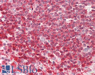 PFN1 / Profilin 1 Antibody - Human Spleen: Formalin-Fixed, Paraffin-Embedded (FFPE).  This image was taken for the unconjugated form of this product. Other forms have not been tested.