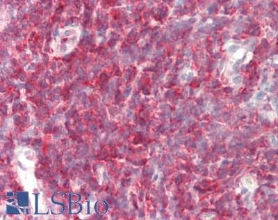 PFN1 / Profilin 1 Antibody - Human Tonsil: Formalin-Fixed, Paraffin-Embedded (FFPE).  This image was taken for the unconjugated form of this product. Other forms have not been tested.