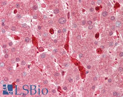 PFN1 / Profilin 1 Antibody - Human Liver: Formalin-Fixed, Paraffin-Embedded (FFPE).  This image was taken for the unconjugated form of this product. Other forms have not been tested.