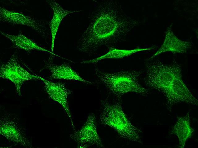 PFN1 / Profilin 1 Antibody - Immunofluorescence staining of PFN1 in HeLa cells. Cells were fixed with 4% PFA, permeabilzed with 0.3% Triton X-100 in PBS, blocked with 10% serum, and incubated with rabbit anti-Human PFN1 polyclonal antibody (dilution ratio 1:1000) at 4°C overnight. Then cells were stained with the Alexa Fluor 488-conjugated Goat Anti-rabbit IgG secondary antibody (green). Positive staining was localized to cytoplasm.