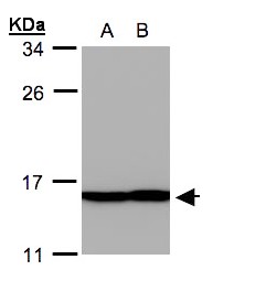 PFN2 / Profilin 2 Antibody - Sample (30 ug whole cell lysate). A: A431, B: H1299. 12% SDS PAGE. Profilin 2 antibody diluted at 1:500
