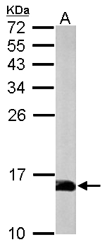 PFN2 / Profilin 2 Antibody - Sample (50 ug of whole cell lysate). A: mouse brain. 15% SDS PAGE. Profilin 2 antibody diluted at 1:1000.
