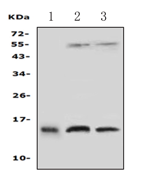 PFN2 / Profilin 2 Antibody - Western blot analysis of PFN2 using anti-PFN2 antibody. Electrophoresis was performed on a 5-20% SDS-PAGE gel at 70V (Stacking gel) / 90V (Resolving gel) for 2-3 hours. The sample well of each lane was loaded with 50ug of sample under reducing conditions. Lane 1: human placenta tissue lysates, Lane 2: rat brain tissue lysates, Lane 3: mouse brain tissue lysates, After Electrophoresis, proteins were transferred to a Nitrocellulose membrane at 150mA for 50-90 minutes. Blocked the membrane with 5% Non-fat Milk/ TBS for 1.5 hour at RT. The membrane was incubated with rabbit anti-PFN2 antigen affinity purified polyclonal antibody at 0.5 µg/mL overnight at 4°C, then washed with TBS-0.1% Tween 3 times with 5 minutes each and probed with a goat anti-rabbit IgG-HRP secondary antibody at a dilution of 1:10000 for 1.5 hour at RT. The signal is developed using an Enhanced Chemiluminescent detection (ECL) kit with Tanon 5200 system. A specific band was detected for PFN2 at approximately 15KD. The expected band size for PFN2 is at 15KD.