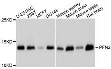 PFN2 / Profilin 2 Antibody - Western blot analysis of extracts of various cell lines.