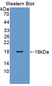 PFN3 Antibody - Western blot of PFN3 antibody.