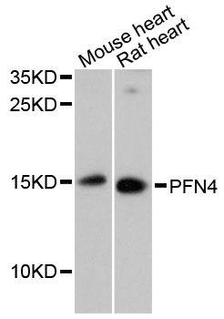 PFN4 Antibody - Western blot analysis of extracts of various cell lines, using PFN4 antibody at 1:3000 dilution. The secondary antibody used was an HRP Goat Anti-Rabbit IgG (H+L) at 1:10000 dilution. Lysates were loaded 25ug per lane and 3% nonfat dry milk in TBST was used for blocking. An ECL Kit was used for detection and the exposure time was 5min.