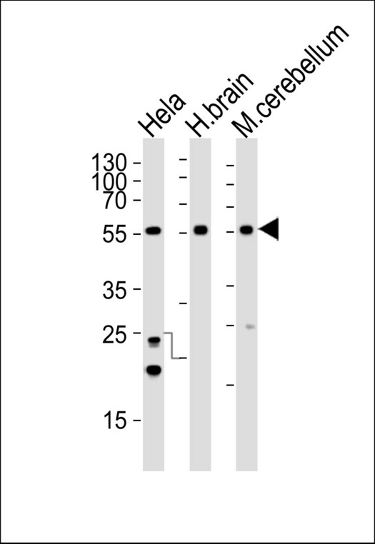 PFTK1 / CDK14 Antibody - Western blot of lysates from HeLa cell line , human brain and mouse cerebellum tissue lysate(from left to right), using PFTK1 Antibody (N-term ). Antibody was diluted at 1:1000 at each lane. A goat anti-rabbit IgG H&L (HRP) at 1:5000 dilution was used as the secondary antibody. Lysates at 35ug per lane.