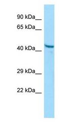 PGA3 Antibody - PGA3 antibody Western Blot of A549.  This image was taken for the unconjugated form of this product. Other forms have not been tested.