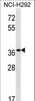 PGA5 / Pepsin A Antibody - PGA5 Antibody western blot of NCI-H292 cell line lysates (35 ug/lane). The PGA5 antibody detected the PGA5 protein (arrow).