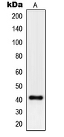 PGA5 / Pepsin A Antibody - Western blot analysis of Pepsin A expression in HepG2 (A) whole cell lysates.