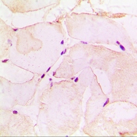 PGA5 / Pepsin A Antibody - Immunohistochemical analysis of Pepsin A staining in human muscle formalin fixed paraffin embedded tissue section. The section was pre-treated using heat mediated antigen retrieval with sodium citrate buffer (pH 6.0). The section was then incubated with the antibody at room temperature and detected using an HRP conjugated compact polymer system. DAB was used as the chromogen. The section was then counterstained with hematoxylin and mounted with DPX.