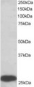 PGAM1/ 2/4 Antibody - Antibody staining (0.5 ug/ml) of human liver lysate (RIPA buffer, 35 ug total protein per lane). Primary incubated for 1 hour. Detected by Western blot of chemiluminescence.