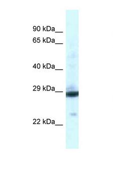 PGAM1 Antibody - PGAM1 antibody Western blot of Fetal Liver lysate. Antibody concentration 1 ug/ml.  This image was taken for the unconjugated form of this product. Other forms have not been tested.
