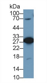 PGAM1 Antibody - Western Blot; Sample: Human A431 cell lysate; Primary Ab: 1µg/ml Rabbit Anti-Human PGAM1 Antibody Second Ab: 0.2µg/mL HRP-Linked Caprine Anti-Rabbit IgG Polyclonal Antibody (Catalog: SAA544Rb19