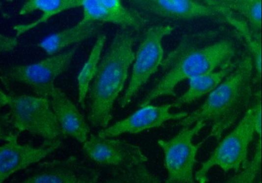 PGAM1 Antibody - Immunocytochemistry/Immunofluorescence: PGAM1 Antibody - Analysis of PGAM1 in HeLa cells.  This image was taken for the unconjugated form of this product. Other forms have not been tested.