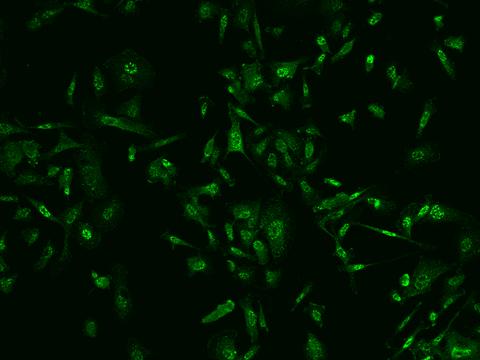 PGAM1 Antibody - Immunofluorescence staining of PGAM1 in PC3 cells. Cells were fixed with 4% PFA, permeabilzed with 0.1% Triton X-100 in PBS, blocked with 10% serum, and incubated with rabbit anti-Human PGAM1 polyclonal antibody (dilution ratio 1:200) at 4°C overnight. Then cells were stained with the Alexa Fluor 488-conjugated Goat Anti-rabbit IgG secondary antibody (green). Positive staining was localized to Nucleus and cytoplasm.