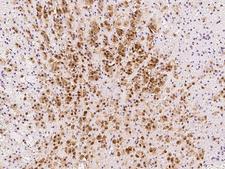 PGAM1 Antibody - Immunochemical staining of human PGAM1 in human adrenal gland with rabbit polyclonal antibody at 1:500 dilution, formalin-fixed paraffin embedded sections.