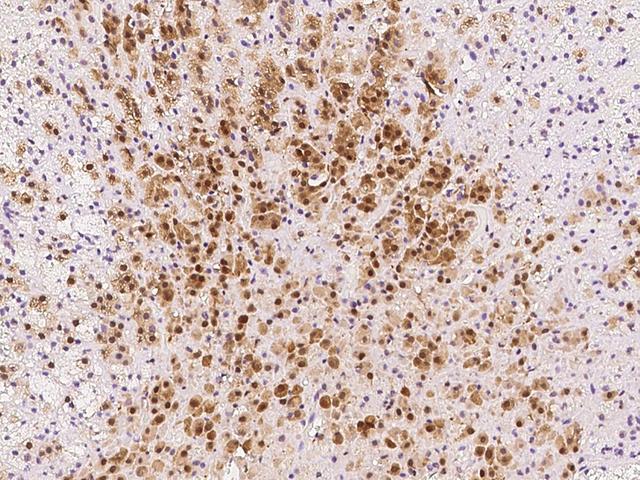 PGAM1 Antibody - Immunochemical staining of human PGAM1 in human adrenal gland with rabbit polyclonal antibody at 1:500 dilution, formalin-fixed paraffin embedded sections.