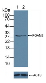 PGAM2 Antibody - Knockout Varification: Lane 1: Wild-type Hela cell lysate; Lane 2: PGAM2 knockout Hela cell lysate; Predicted MW: 29kd Observed MW: 29kd Primary Ab: 1µg/ml Rabbit Anti-Human PGAM2 Antibody Second Ab: 0.2µg/mL HRP-Linked Caprine Anti-Rabbit IgG Polyclonal Antibody