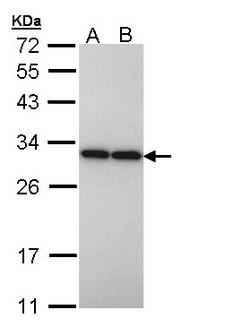 PGAM2 Antibody - Sample (30 ug of whole cell lysate). A: H1299, B: Hela. 12% SDS PAGE. PGAM2 antibody diluted at 1:10000.