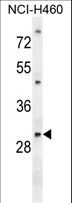 PGAM2 Antibody - PGAM2 Antibody western blot of NCI-H460 cell line lysates (35 ug/lane). The PGAM2 antibody detected the PGAM2 protein (arrow).
