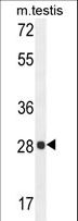 PGAM2 Antibody - PGAM2 Antibody western blot of mouse testis tissue lysates (35 ug/lane). The PGAM2 antibody detected the PGAM2 protein (arrow).