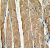 PGAM2 Antibody - PGAM2 antibody immunohistochemistry of formalin-fixed and paraffin-embedded human skeletal muscle followed by peroxidase-conjugated secondary antibody and DAB staining.