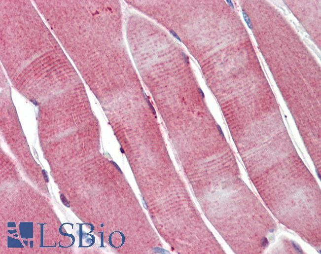 PGAM2 Antibody - Anti-PGAM2 antibody IHC staining of human skeletal muscle. Immunohistochemistry of formalin-fixed, paraffin-embedded tissue after heat-induced antigen retrieval.