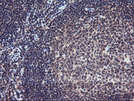 PGAM2 Antibody - IHC of paraffin-embedded Human tonsil using anti-PGAM2 mouse monoclonal antibody. (Heat-induced epitope retrieval by 10mM citric buffer, pH6.0, 100C for 10min).