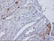 PGAM2 Antibody - IHC of paraffin-embedded Human Kidney tissue using anti-PGAM2 mouse monoclonal antibody.