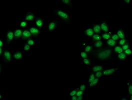 PGAM2 Antibody - Immunofluorescent staining of HeLa cells using anti-PGAM2 mouse monoclonal antibody.