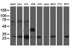 PGAM2 Antibody - Western blot of extracts (35 ug) from 9 different cell lines by using anti-PGAM2 monoclonal antibody.