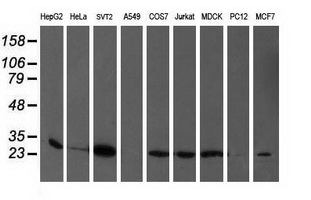 PGAM2 Antibody - Western blot of extracts (35 ug) from 9 different cell lines by using anti-PGAM2 monoclonal antibody.